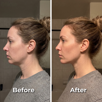 OLB - Visible Facial Sculpting in Minutes